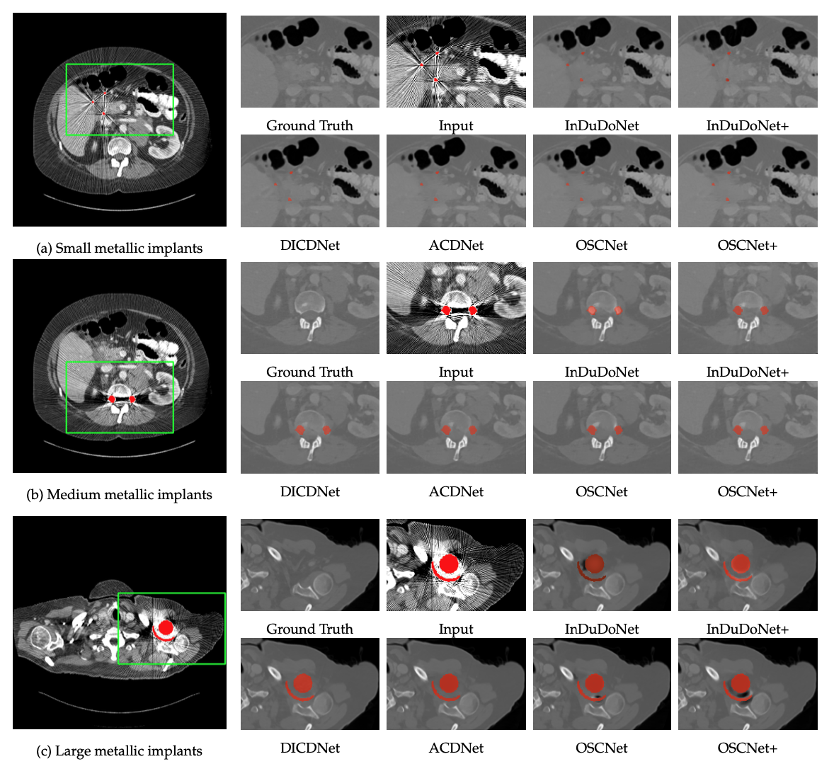 Deep Learning for Metal Artifact Reduction in CT Imaging